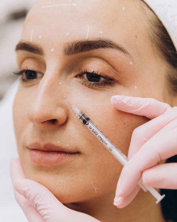 FullFace botox kezelés